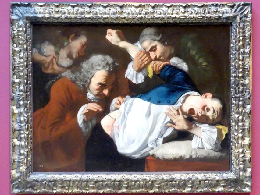 Gaspare Traversi (1750–1754), Die Operation, Stuttgart, Staatsgalerie, Italienische Malerei 1, um 1753–1754, Bild 1/2